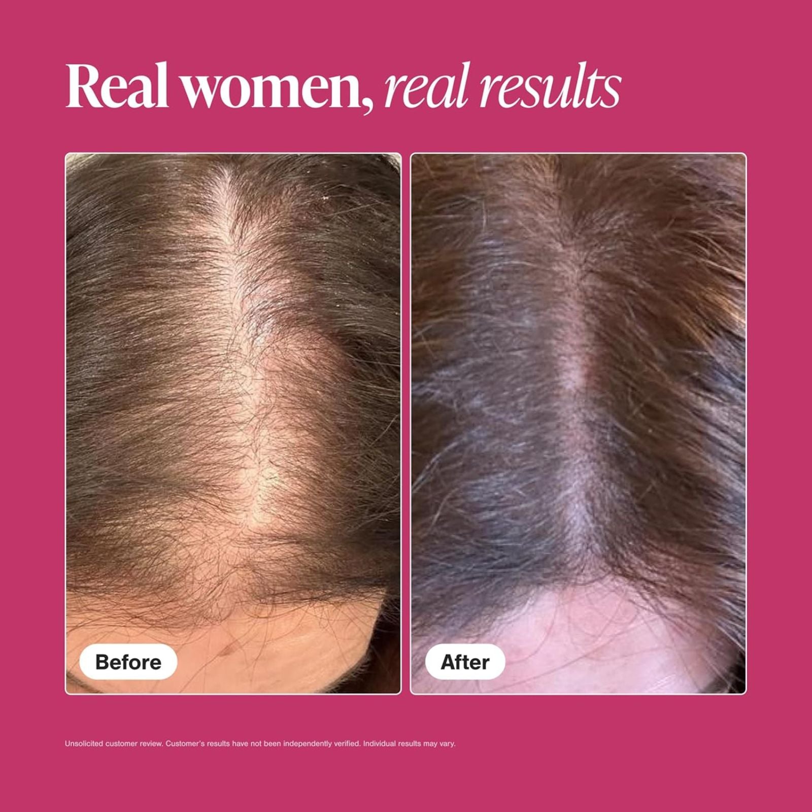 Viviscal Women Hair Growth Supplement 180 Tablets Bundle of 4