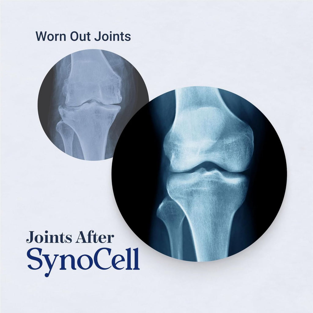 Synocell Glucosamine Chondroitin Complex Joint Support Bundle of 4