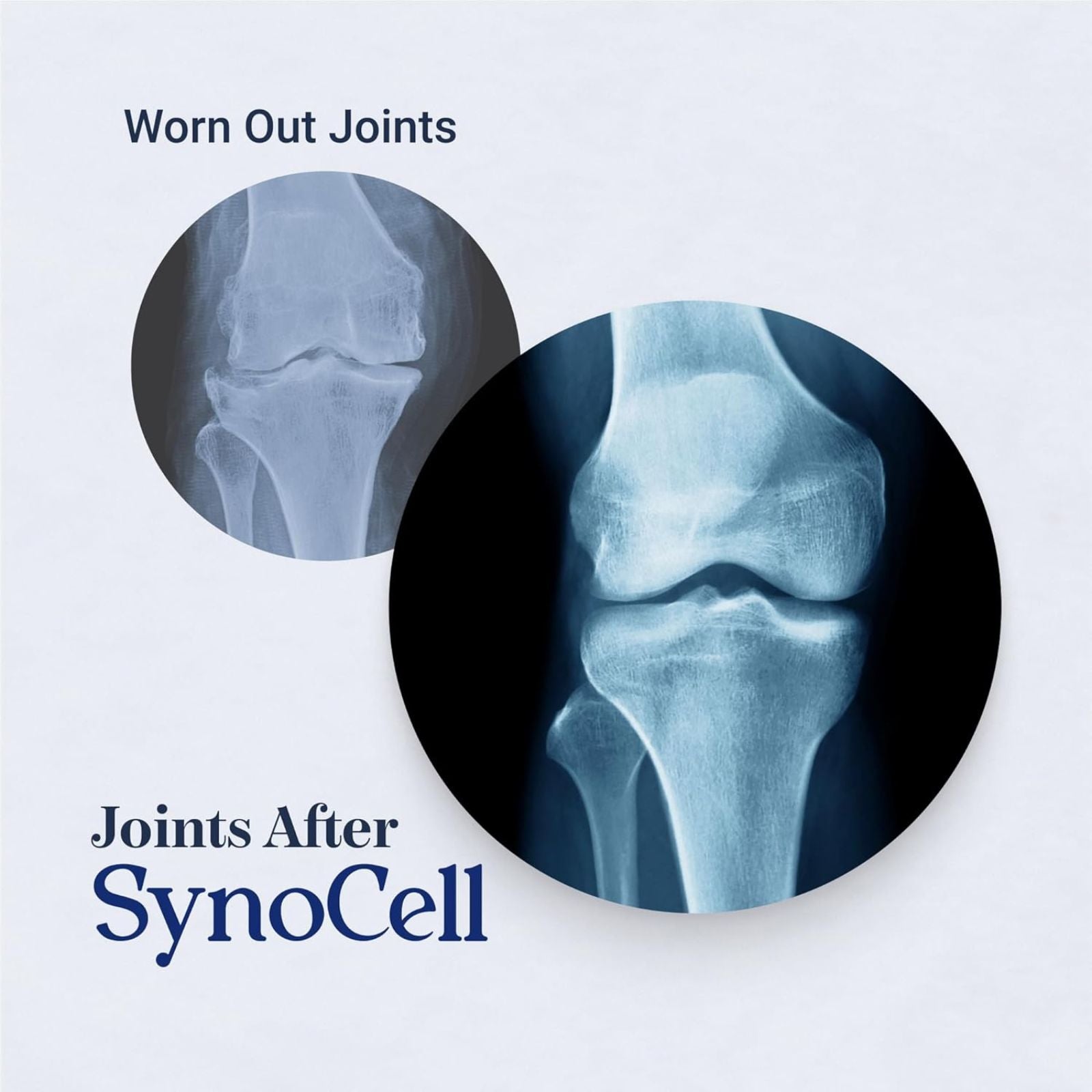 Synocell Glucosamine Chondroitin Complex Joint Support Bundle of 4
