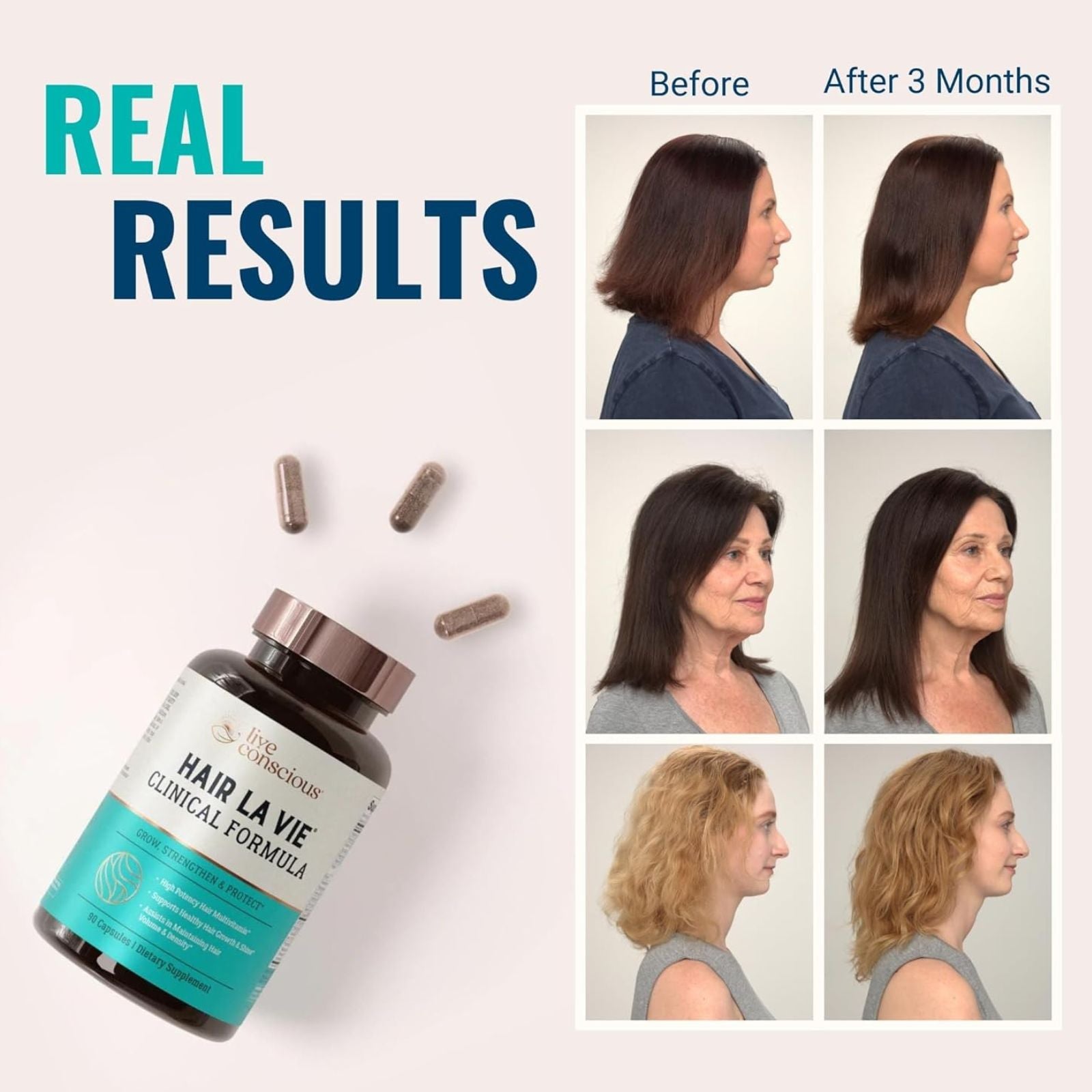 Hair La Vie Clinical Formula Hair Vitamins with Biotin Bundle of 4