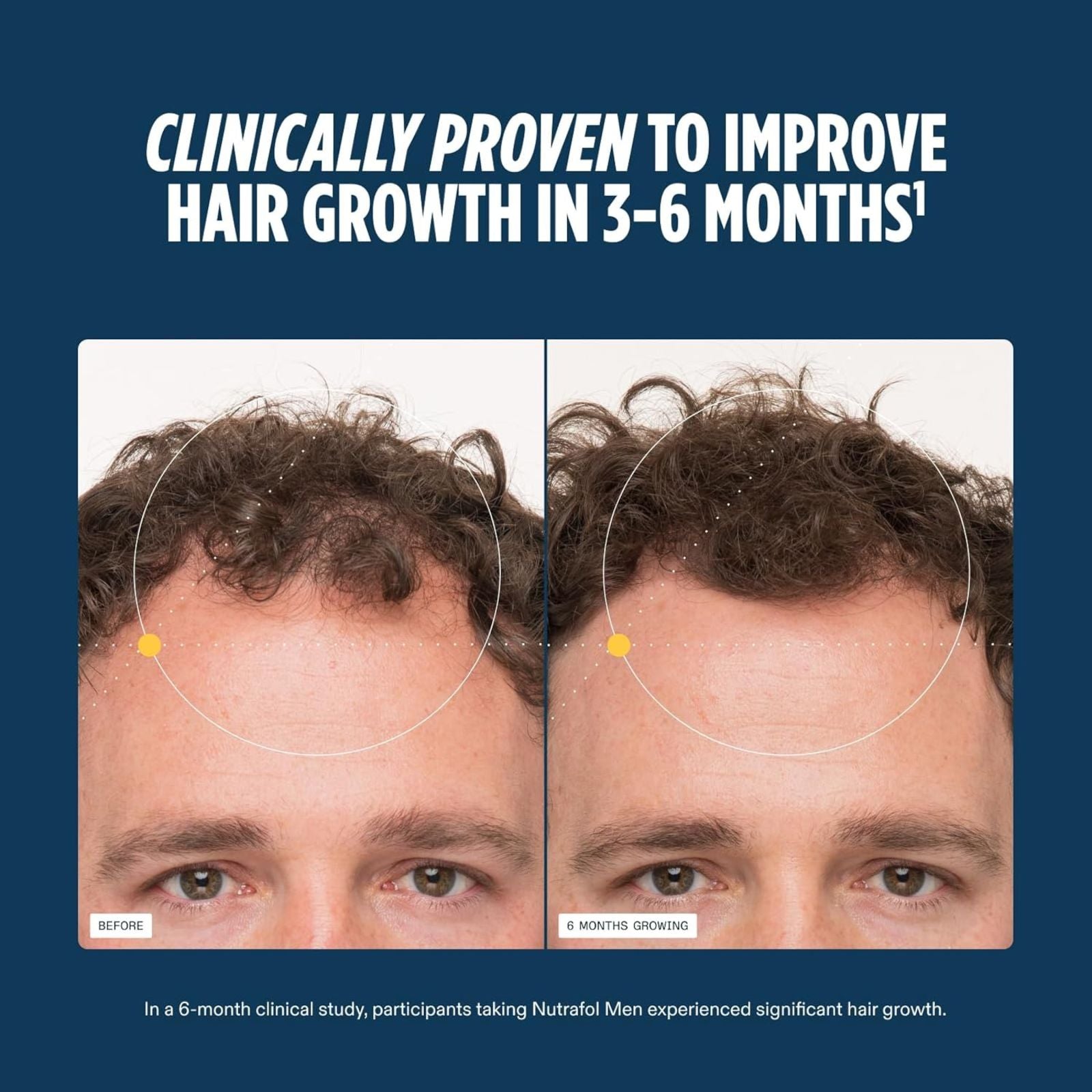 Nutrafol Men Hair Growth Nutraceutical 120 Capsules Bundle of 4
